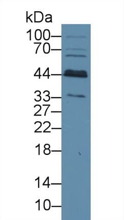 BCAT1 / ECA39 Antibody (APC, Cy7)