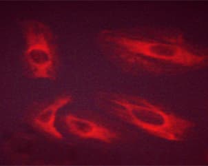 Polyclonal Rabbit anti-Human FGFR1 / FGF Receptor 1 Antibody (phospho-Tyr654, IF, WB)