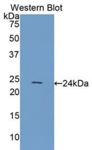 HSPB8 / H11 / HSP22 Antibody (aa1-196)