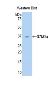 SFTPD / Surfactant Protein D Antibody (aa21-375, PE)