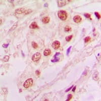 Polyclonal Rabbit anti-Human PARK7 / DJ-1 Antibody (Internal, IHC, IF, WB)