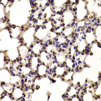BHLHB2 / DEC1 Antibody