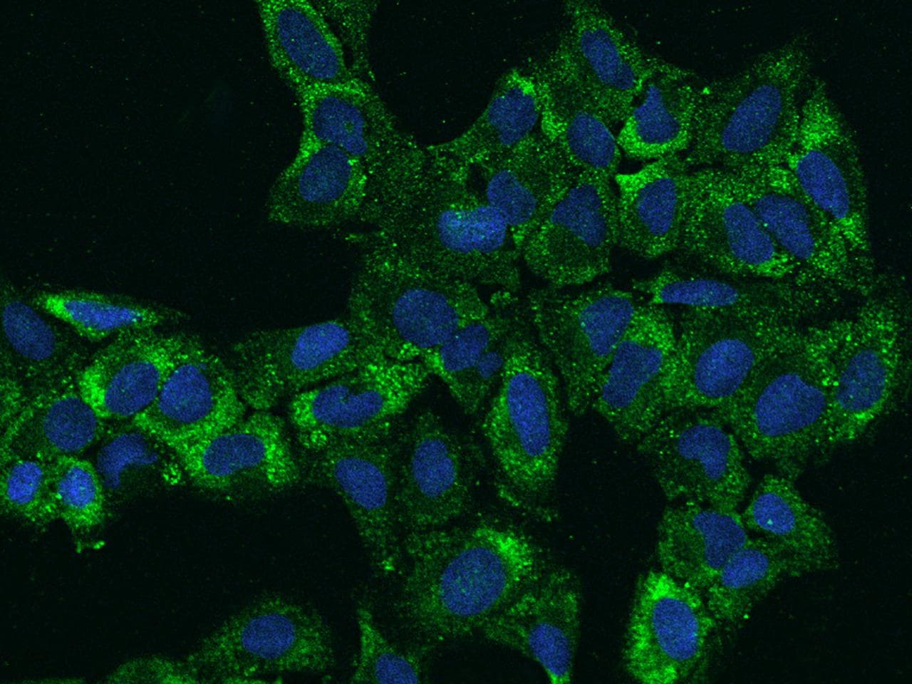 Polyclonal Rabbit anti-Human PAI-RBP1 / SERBP1 Antibody (IF)