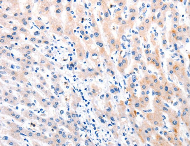 MTOR Antibody