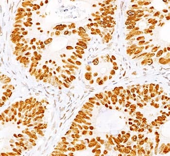 TP53 / p53 Antibody (clone BP53-12 + DO-7, Ready-to-Use)