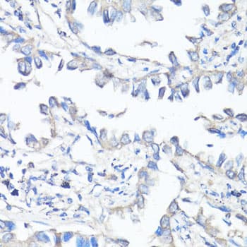 Polyclonal Rabbit anti-Human ABCB1 / MDR1 / P Glycoprotein Antibody (IHC, WB)