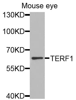 Polyclonal Rabbit anti-Human TRF1 / TERF1 Antibody (IHC, WB)