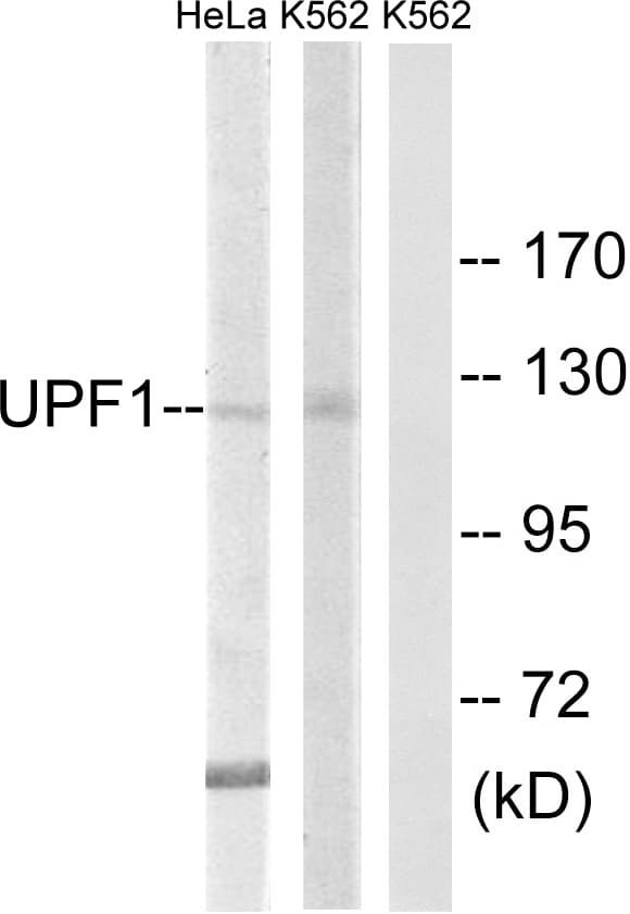 RENT1 / UPF1 Antibody (aa299-348)