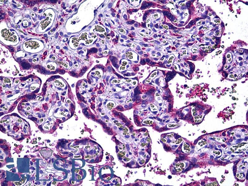 IHC-plus™ NOS3 / eNOS Antibody (aa1181-1194)