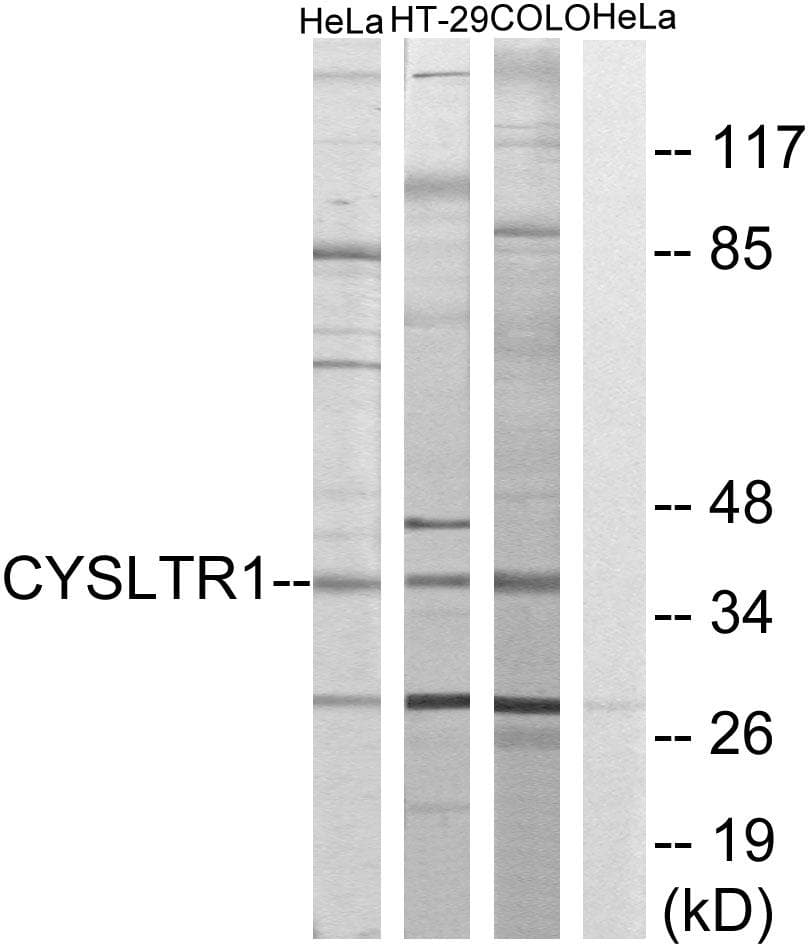 CYSLTR1 / CYSLT1 Antibody