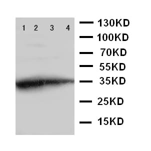 Polyclonal Rabbit anti-Mouse GCN2 Antibody (aa868-886, WB)