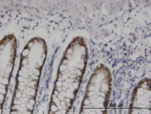 HOXD11 Antibody (clone 6C8)