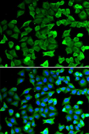 SIRT2 / Sirtuin 2 Antibody