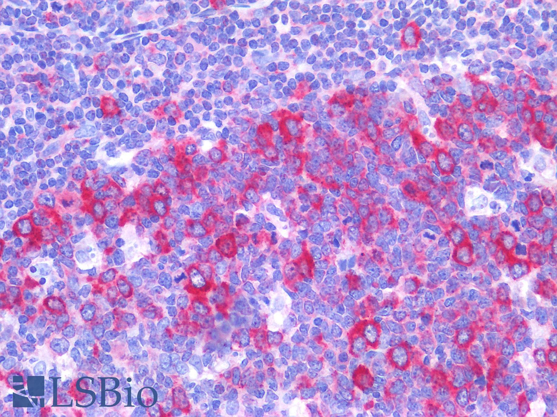 IHC-plus™ Polyclonal Rabbit anti-Human ST14 / Matriptase Antibody (aa10-59, IHC, IF, WB)