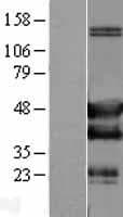 SH3GLB2 / Endophilin-B2 Protein (Over-Expression Lysate Myc-DDK (Flag))