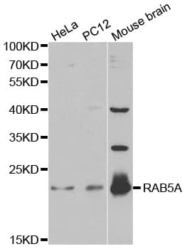 PathPlus™ RAB5A / RAB5 Antibody