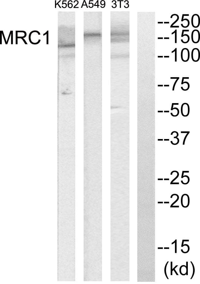 Mannose Receptor / CD206 Antibody