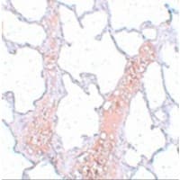 REEP2 Antibody