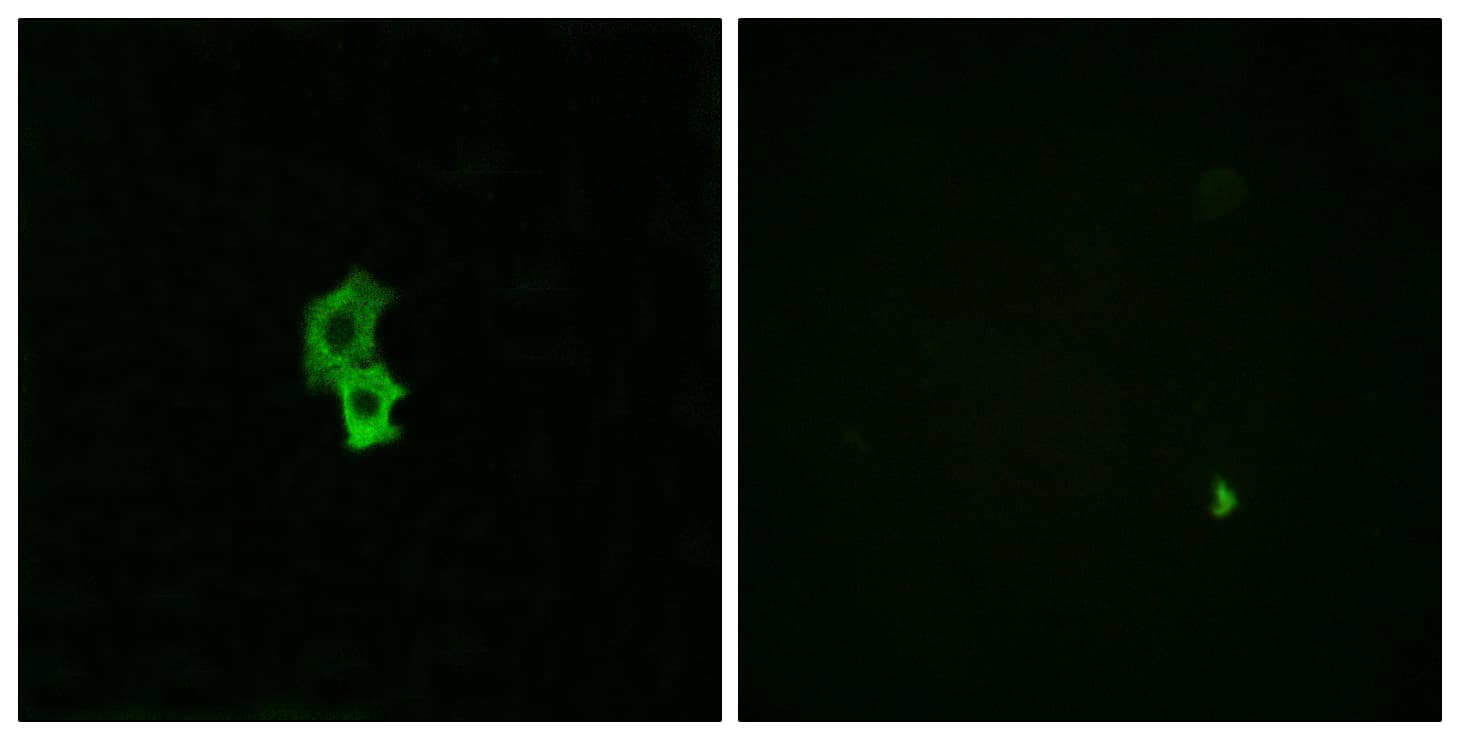 Polyclonal Rabbit anti-Human S1PR4 / SIP4 / EDG6 Antibody (aa326-375, IF, WB)