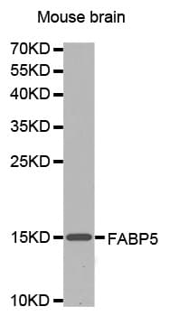 E-FABP / FABP5 Antibody