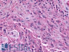 PathPlus™ Polyclonal Rabbit anti-Human GPR137B Antibody (C-Terminus, IHC)
