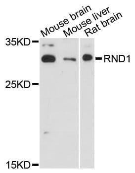 Polyclonal Rabbit anti-Human RND1 Antibody (WB)