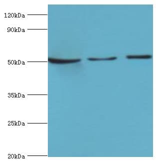 SERPINA10 / PZI Antibody (aa165-444)