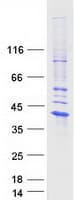 Human IL-1B / IL-1 Beta Protein (Recombinant Myc-DDK (Flag))