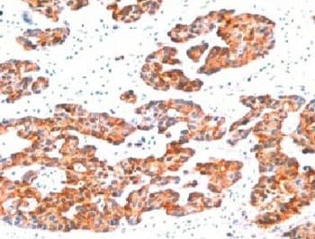 Basic Cytokeratin Antibody (clone BCCK1-1)
