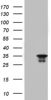 LGALS3 / Galectin 3 Antibody (clone OTI8D7)