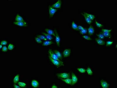 RPL28 / Ribosomal Protein L28 Antibody
