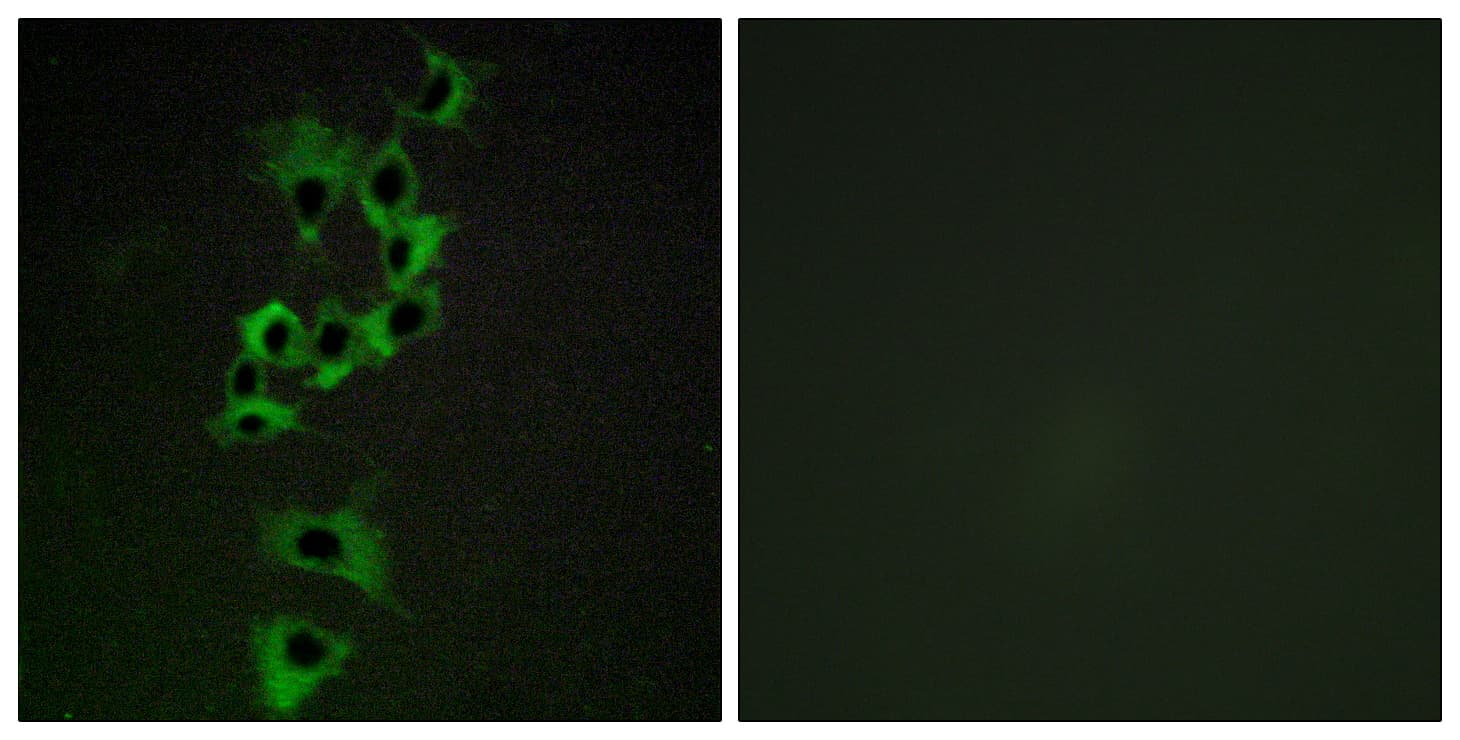 Polyclonal Rabbit anti-Human ERBB4 / HER4 Antibody (aa1250-1299, IHC, IF)