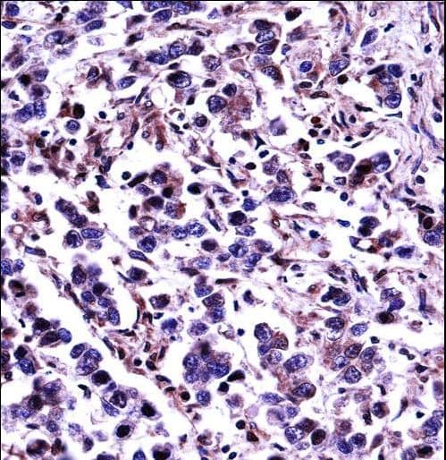 CAPN11 / Calpain 11 Antibody (aa409-438)