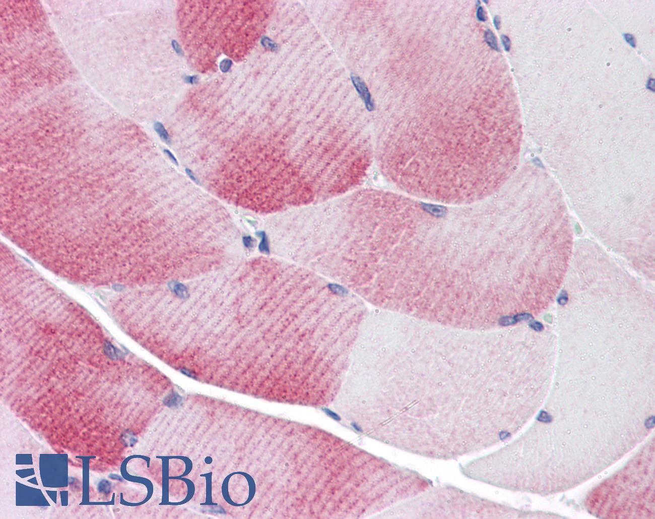 IHC-plus™ MYBPC1 Antibody