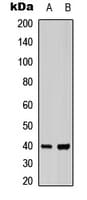 Polyclonal Rabbit anti-Human ACKR4 / CCRL1 / CCR11 Antibody (N-Terminus, IF, WB)