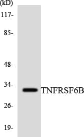 TNFRSF6B / DCR3 Antibody (aa238-287)