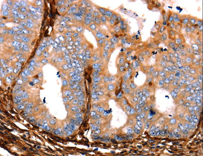 LGALS1 / Galectin 1 Antibody