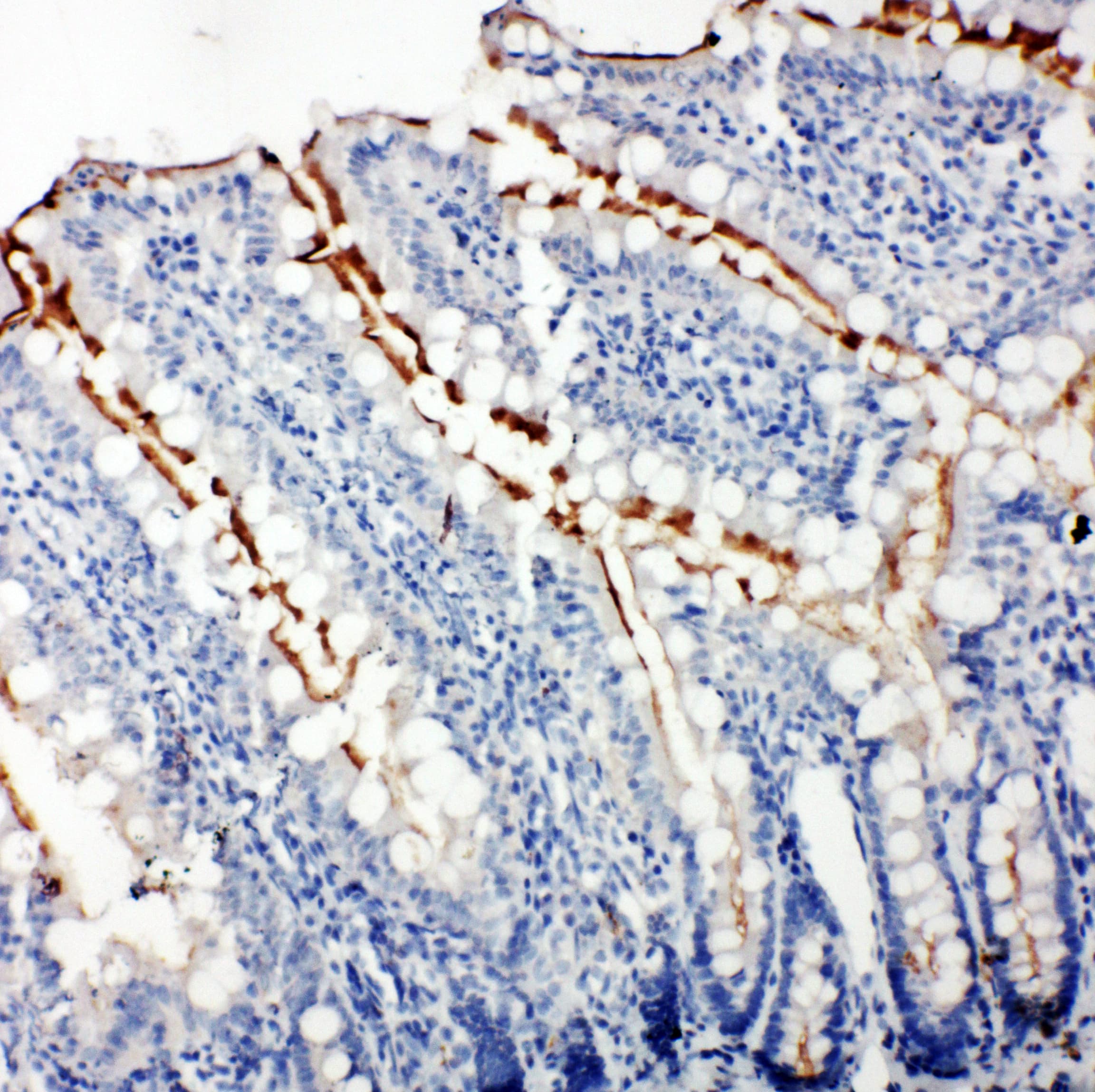 TJP3 / ZO3 Antibody (aa885-905)
