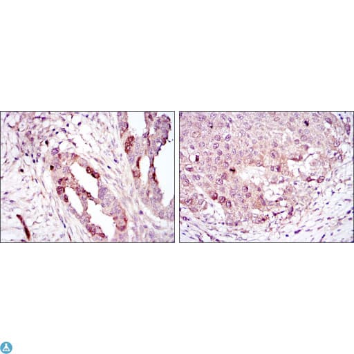 AURKA / Aurora-A Antibody