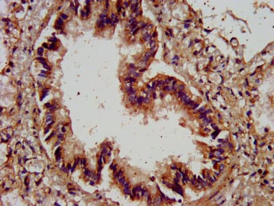 AGRN / Agrin Antibody