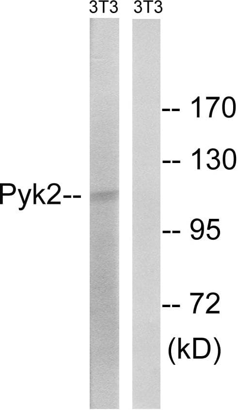 PTK2B / PYK2 Antibody (p579)