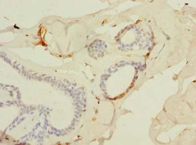 SLC25A4 / ANT Antibody