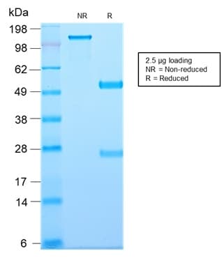 CD81 Antibody (clone C81/2885R, Azide-free, Carrier-free)