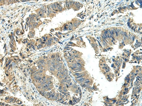 NPVF Antibody
