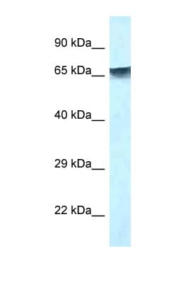 Polyclonal Rabbit anti-Human MBD1 Antibody (C-Terminus, IHC, WB)