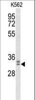 WDR83 Antibody (aa126-154)