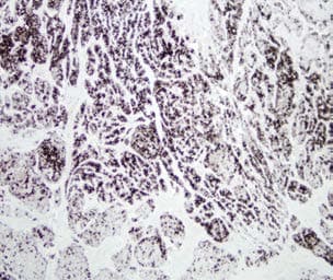 Chymotrypsin Antibody (clone CHYMO10-101.2)
