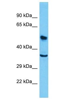 Polyclonal Rabbit anti-Human ZNF254 Antibody (aa221-270, WB)