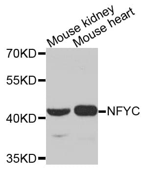 Polyclonal Rabbit anti-Human NFYC Antibody (WB)