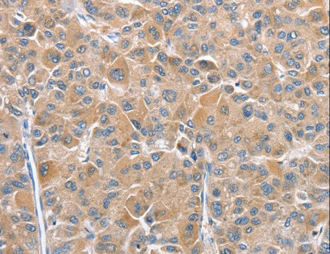 Polyclonal Rabbit anti-Human CHMP4B Antibody (IHC)